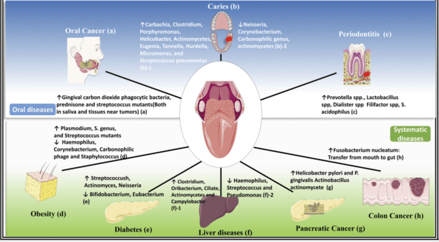 Oral disease