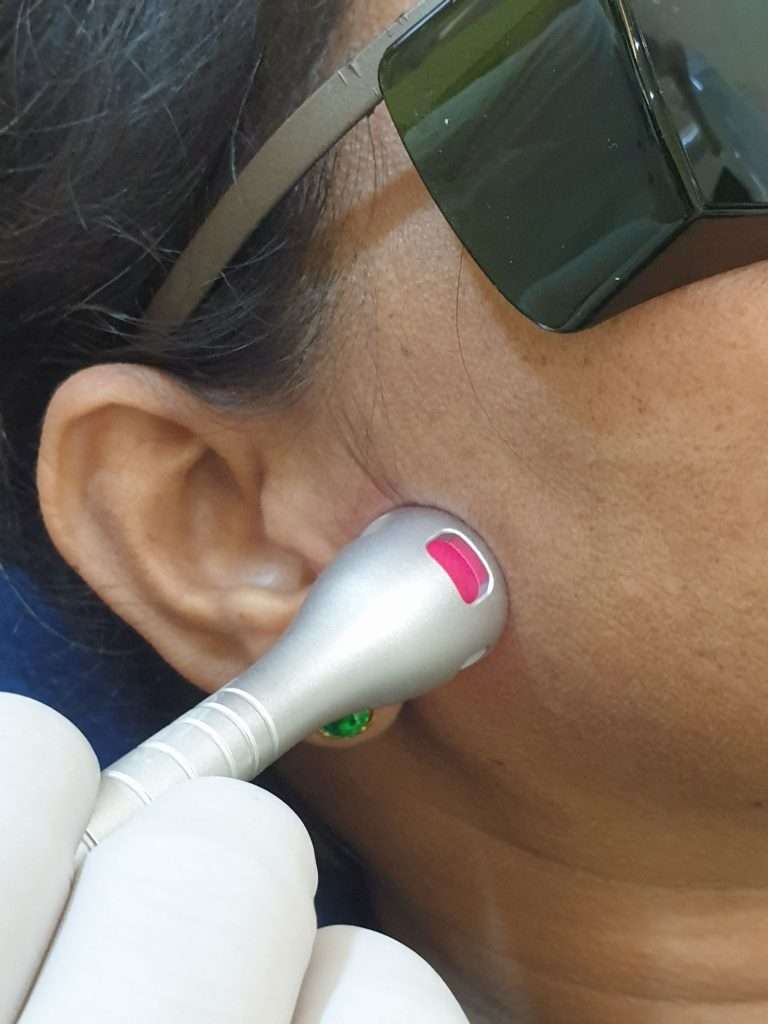 Dr Rao's dental centre provides world class yet affordable laser treatmen