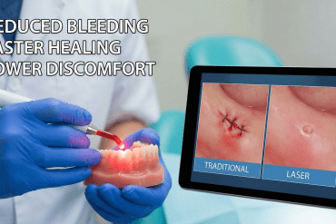 Diode Laser Advantage