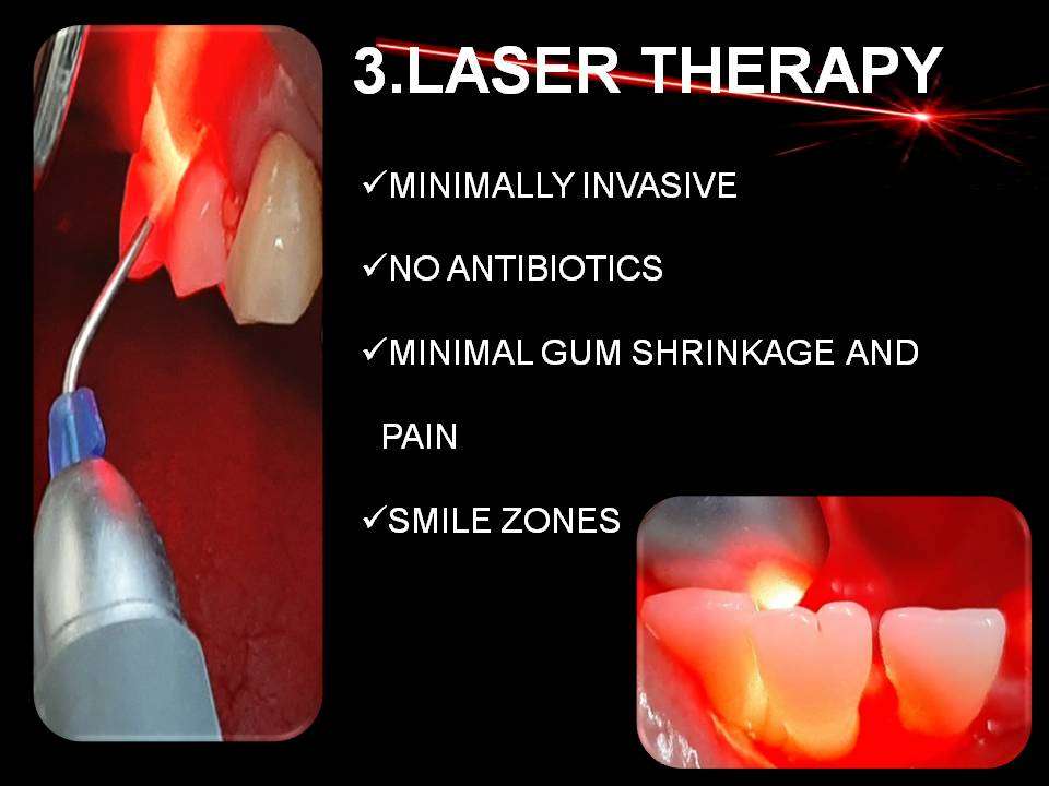 Dr Rao's dental centre provides world class yet affordable laser treatment